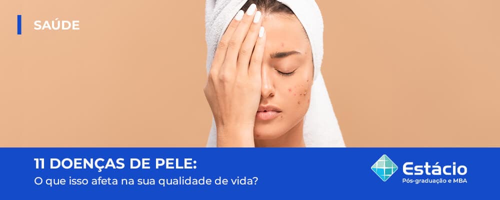 As 11 doenças de pele que mais afetam a qualidade de vida