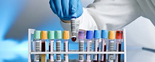 Análises Clínicas: Exames laboratoriais em período pré-natal e neonatal