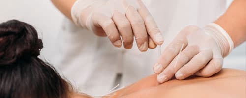 Acupuntura não é prática exclusiva de profissionais médicos, defende Ministério Público Federal