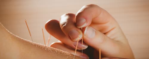 Pós em Acupuntura, com explicação de uma das coordenadoras do curso 