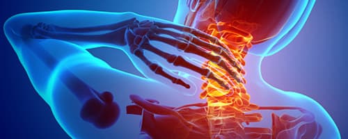 Cervicalgia e a atuação da Fisioterapia 