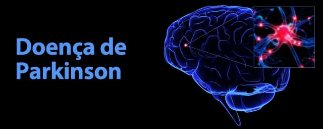 Como tratar a doença de Parkinson?