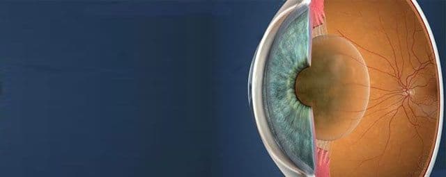 O que é a catarata ocular?