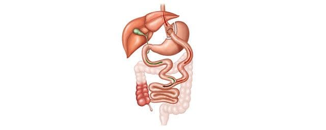 O que é a cirurgia bariátrica