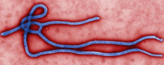 Família de homem com suspeita de ebola fica em quarentena nos EUA